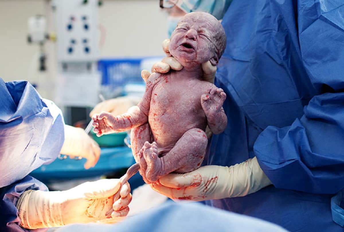   5 popular bollywood actress who jave had a C-Section delivery