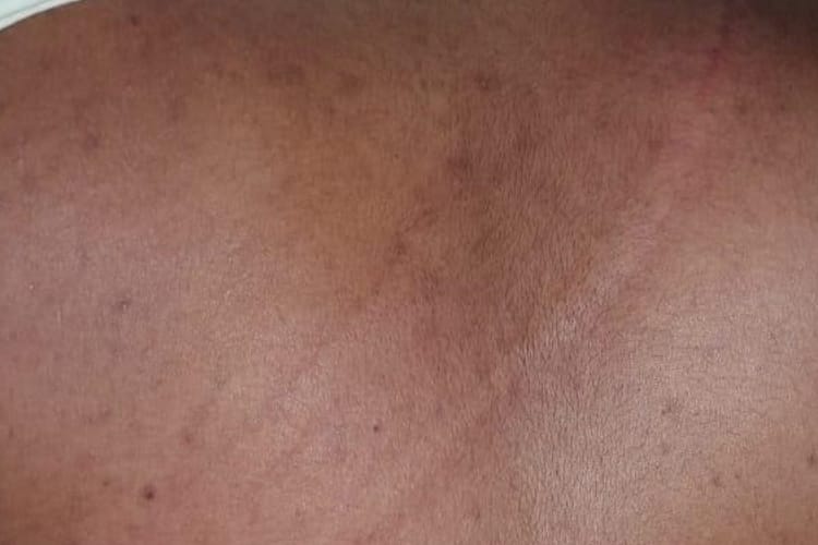 classmates beaten handicapped student in dr shakuntala misra university