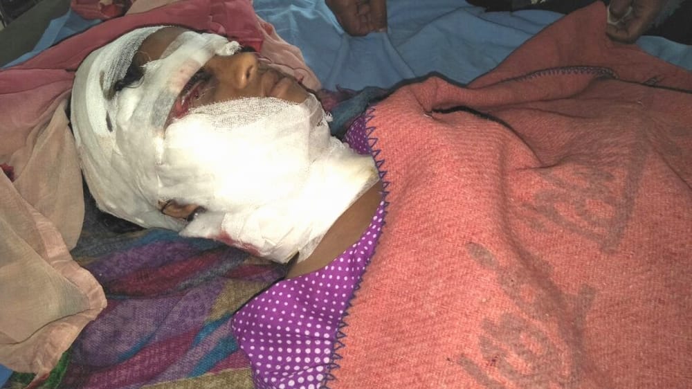 dog bite two girls in roorkee