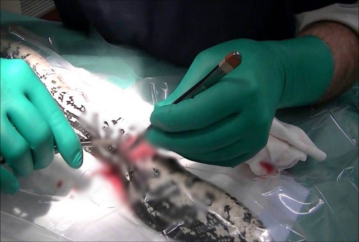 The human being saved the snake life after operation in raipur