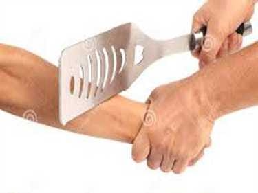 hand cut off on looting protest