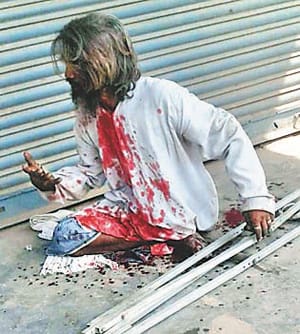 Divyang beggars turned boggling