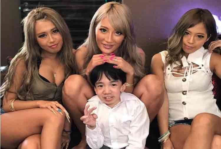 a child porn star but actual 24 year boy have a rare disease