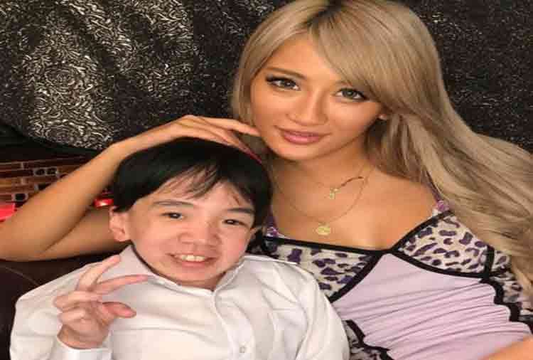 a child porn star but actual 24 year boy have a rare disease