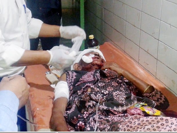 tiger attacks women in forest