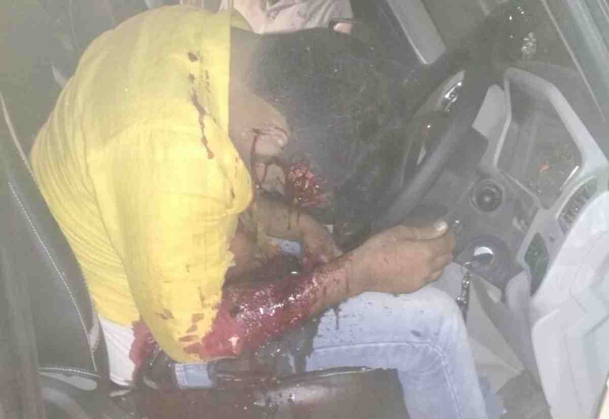 Firing in jaunpur and one killed and one injured