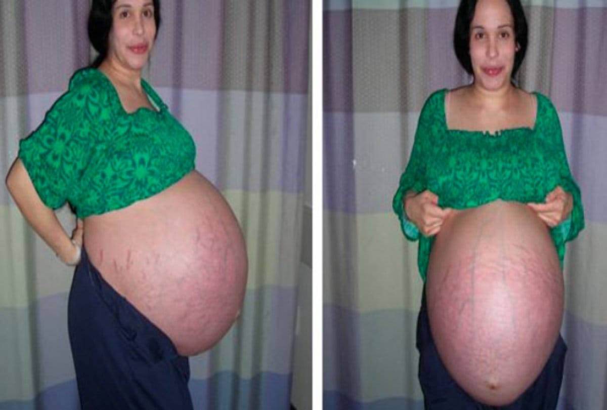 Meet Nadya suleman the Mother of eight children at once now looks extremely different