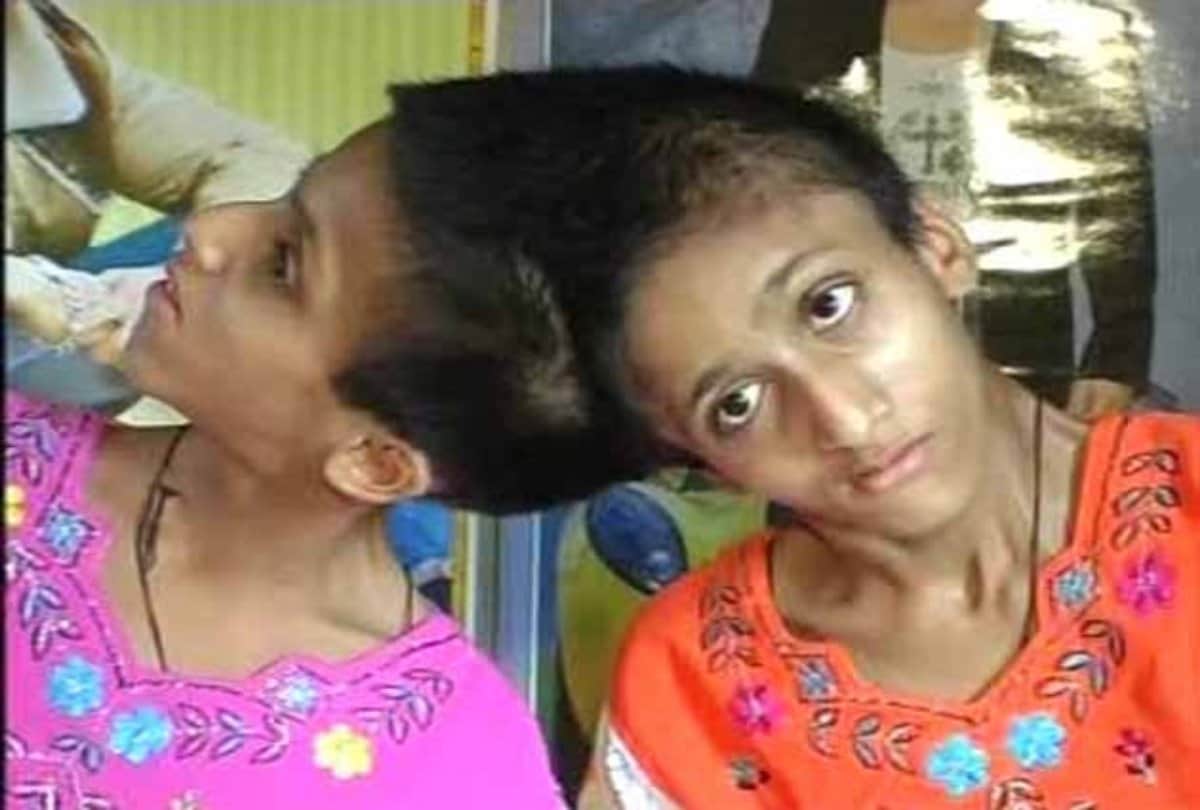 Conjoined Sisters Saba and Farah Salman Khan Fan From Bihar Want To Go To Jail