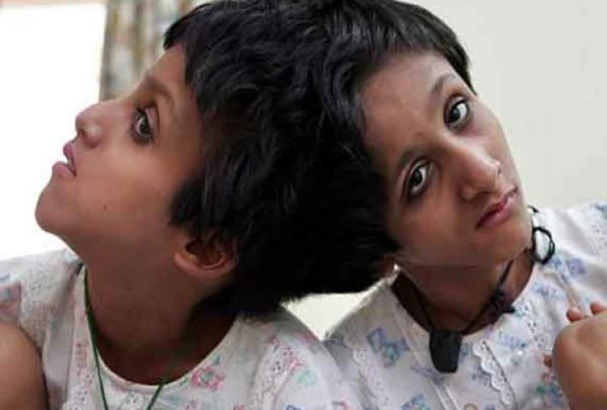 Conjoined Sisters Saba and Farah Salman Khan Fan From Bihar Want To Go To Jail