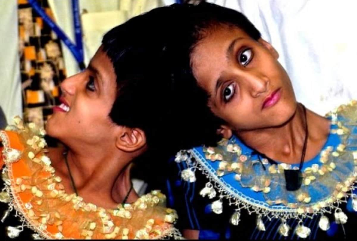 Conjoined Sisters Saba and Farah Salman Khan Fan From Bihar Want To Go To Jail