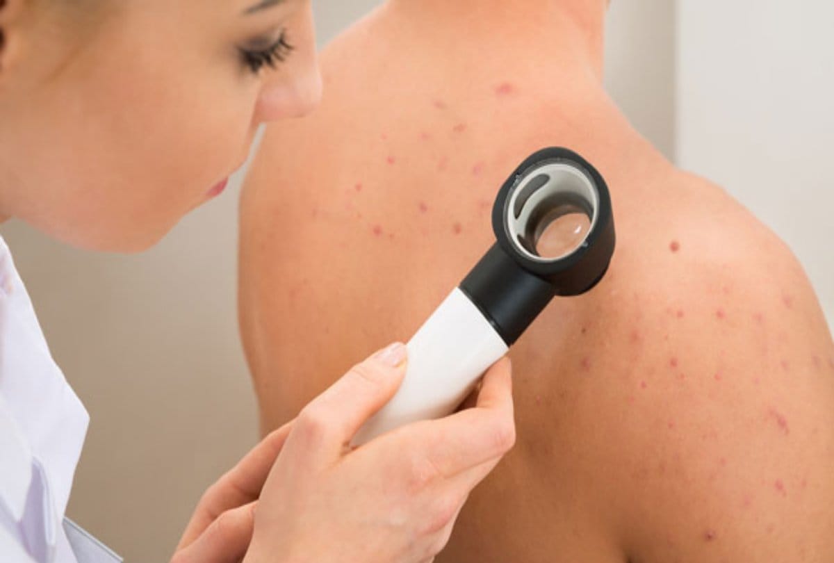 Panjab University discovered effective drug for treatment of skin cancer