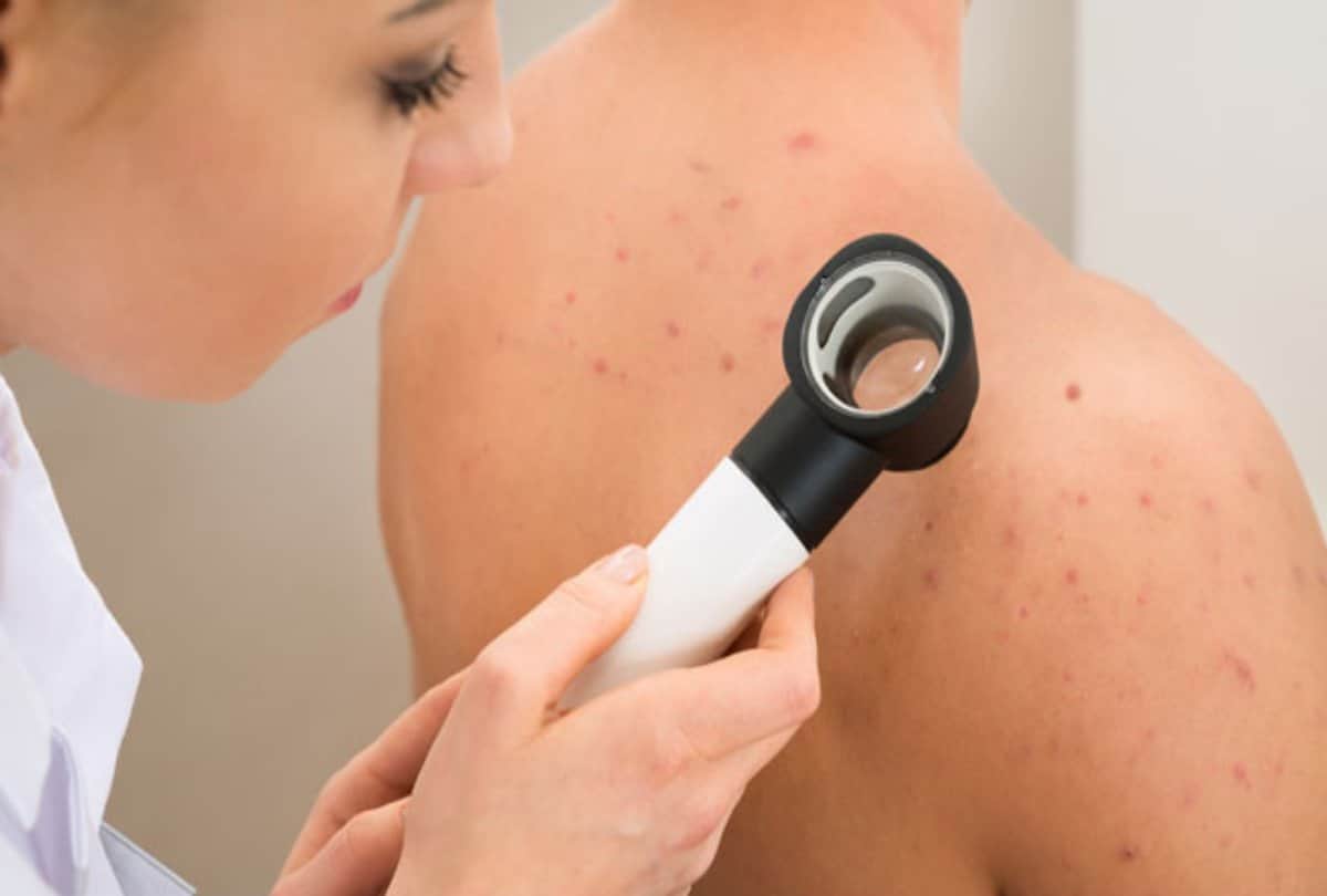 phone and computer could damage your skin