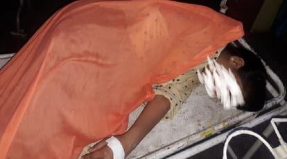 up: Husband throws acid on woman constable, niece wounded