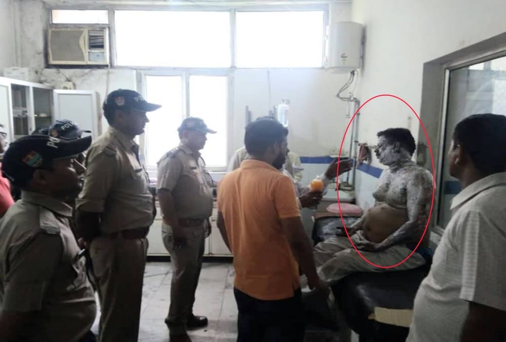 Vhp leader put himself into fire in haridwar against meat shops