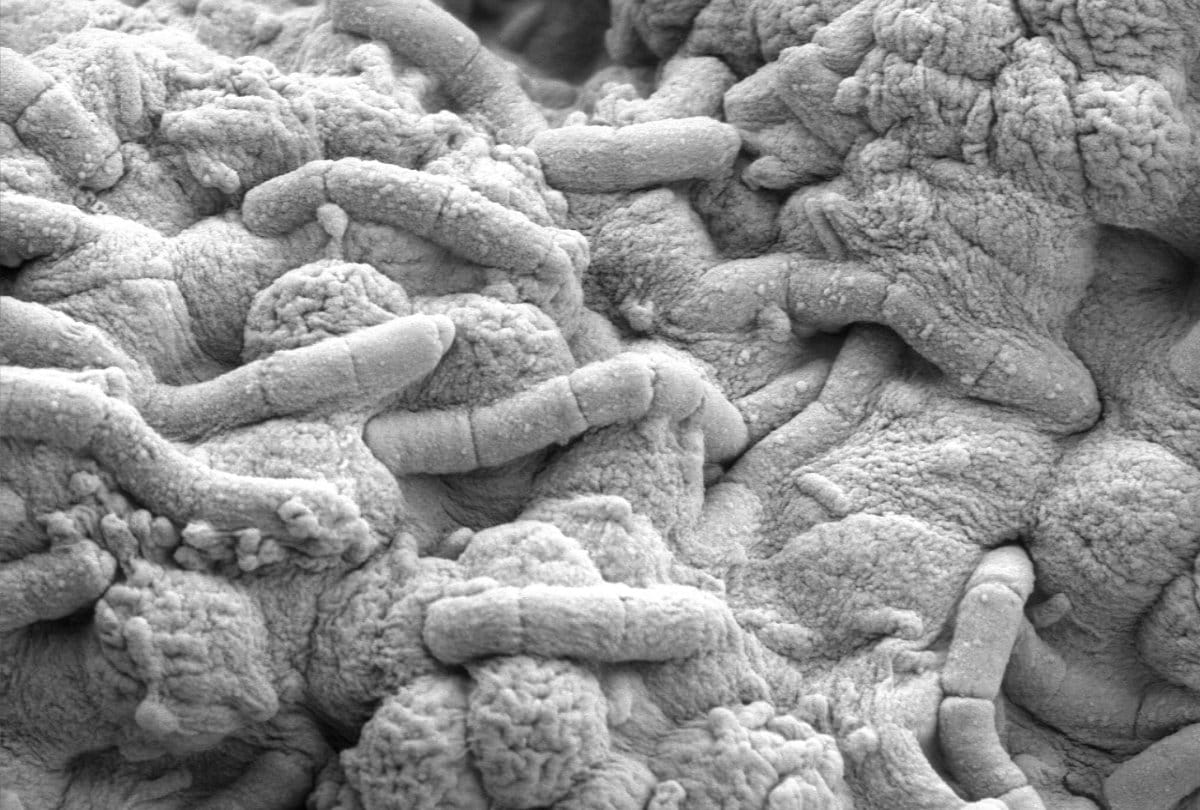 Know How bacteria stick harmful for human cells