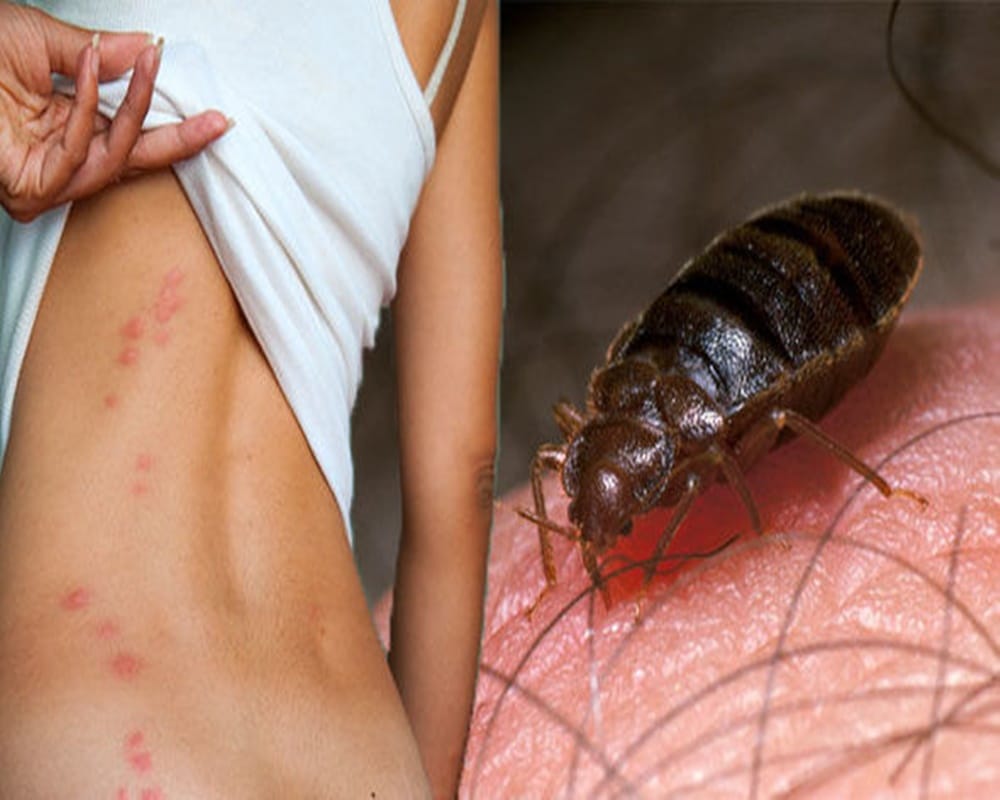 Easy home remedies to get rid of bed bugs 