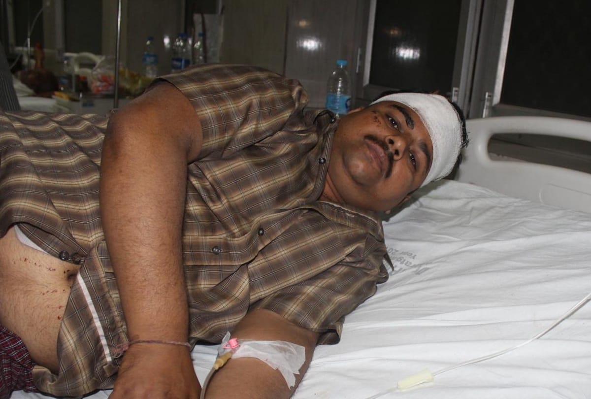 criminals thrown acid on businessman in lucknow