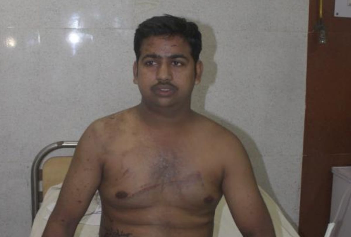 criminals thrown acid on businessman in lucknow