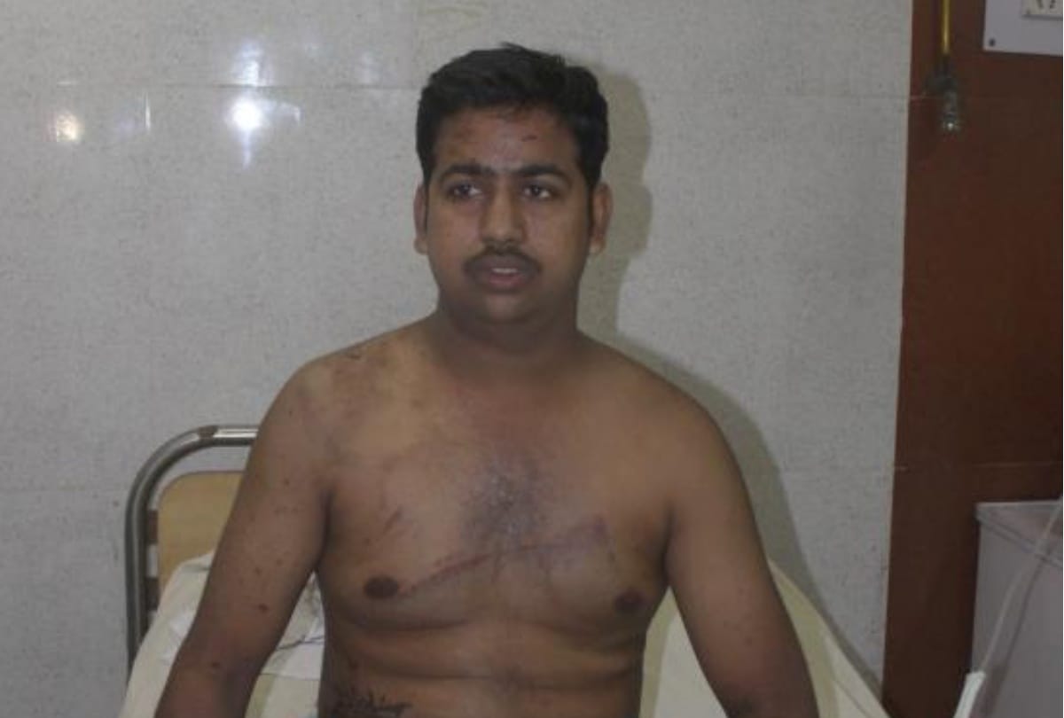 criminals thrown acid on businessman in lucknow