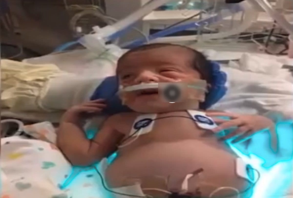 Due to rare genetic disorder little girl look like pregnant