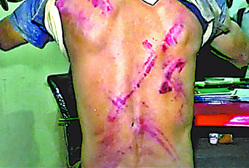 post mortem report on death of rape victim's father in unnao.