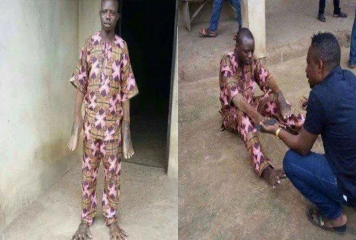 Shocking story behind this viral photos