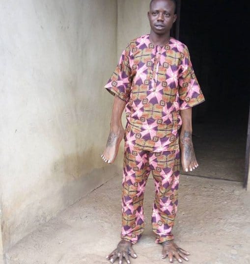 Shocking story behind this viral photos