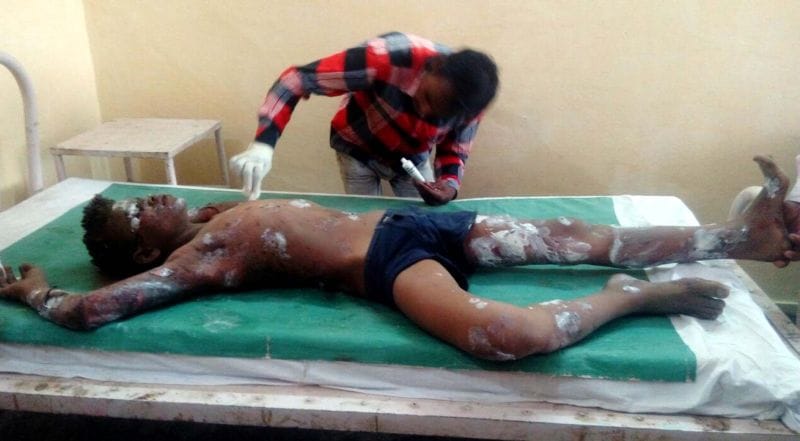 कॉलेज मैदान के कुएं में फटा बम, चार बच्चे घायल