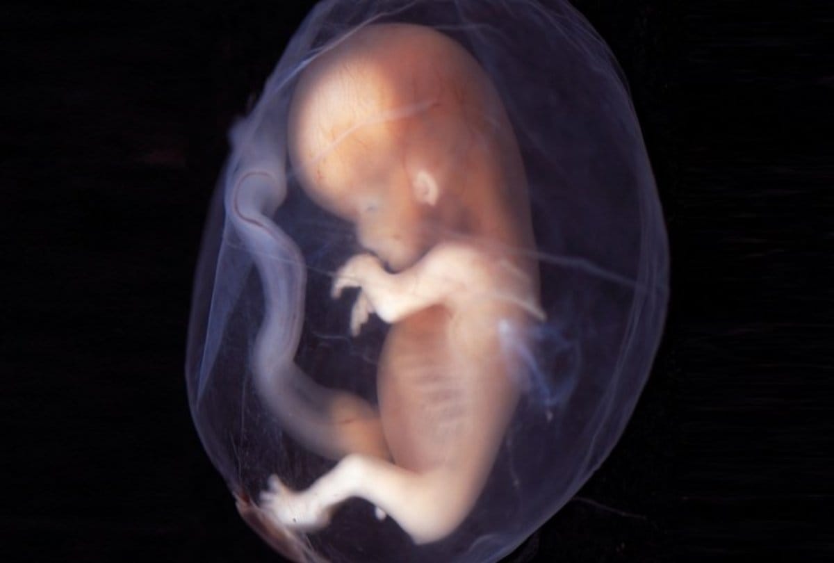 US Couple Welcomes Twins Born From Embryos Frozen 30 Years Ago, Breaks Record