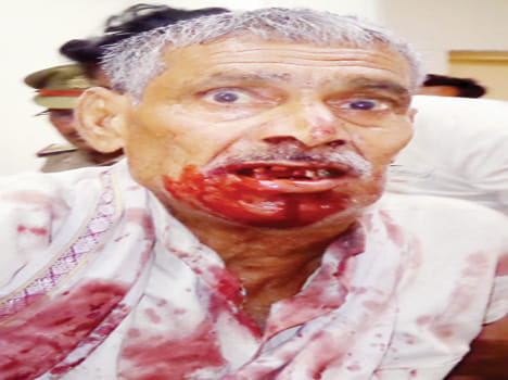 गोली से घायल कृपाशंकर