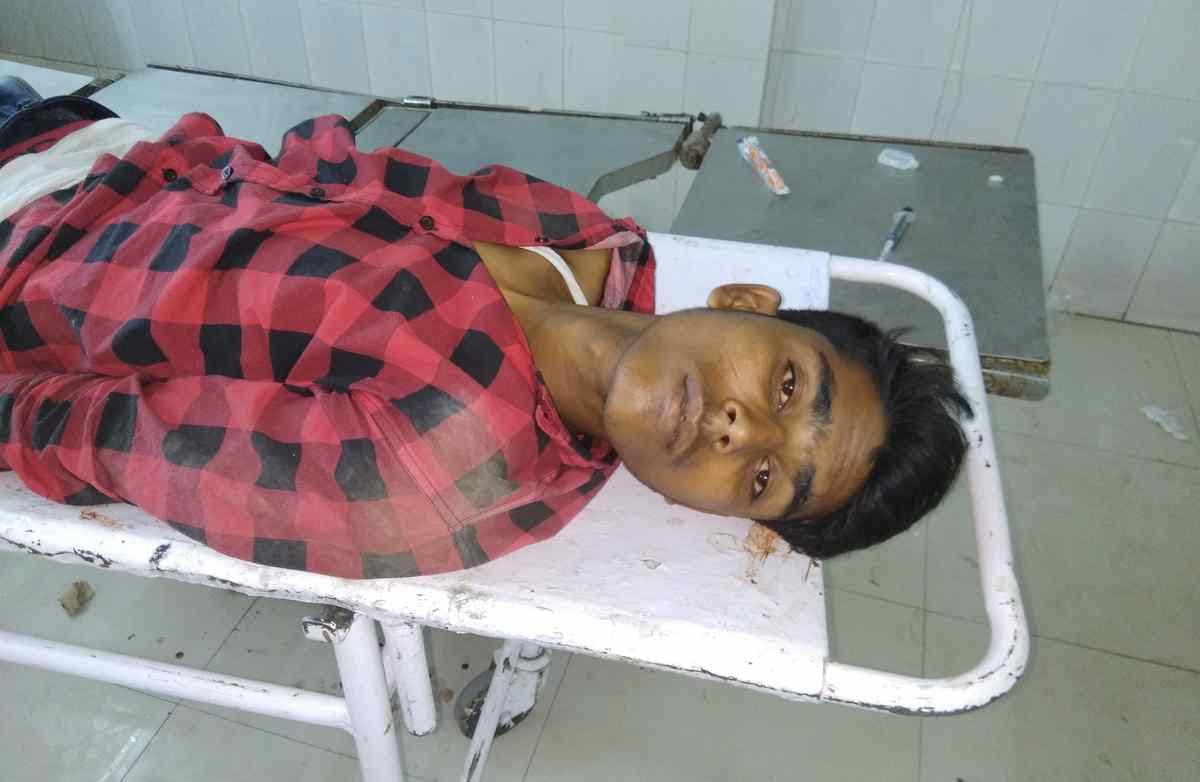 UP Police encounter in azamgarh two criminal injured 