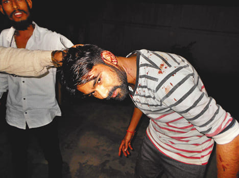 Food Corner Operator beaten with butt