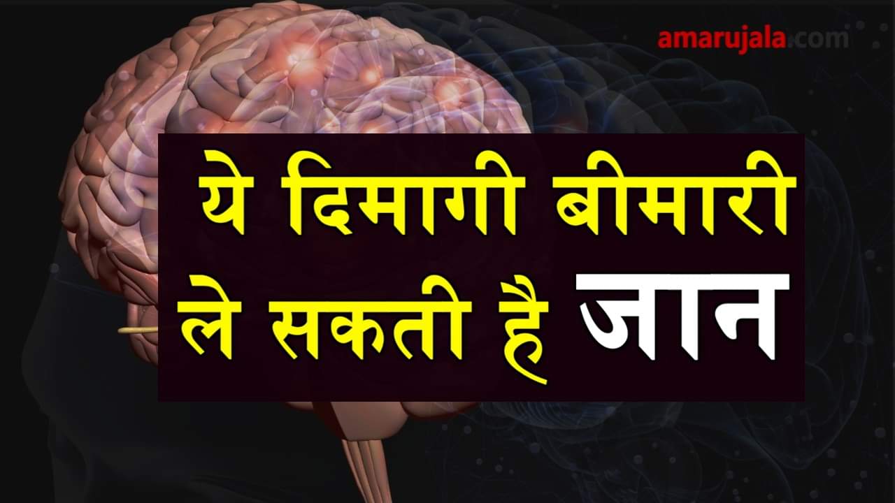  symptoms of brain stroke