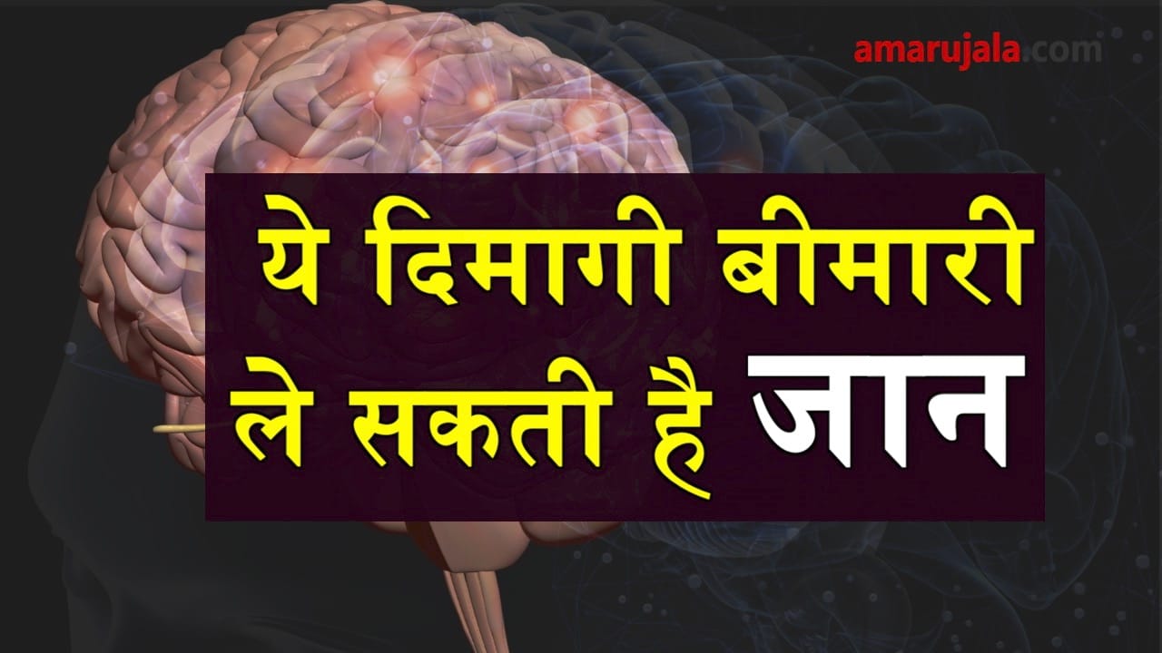  symptoms of brain stroke