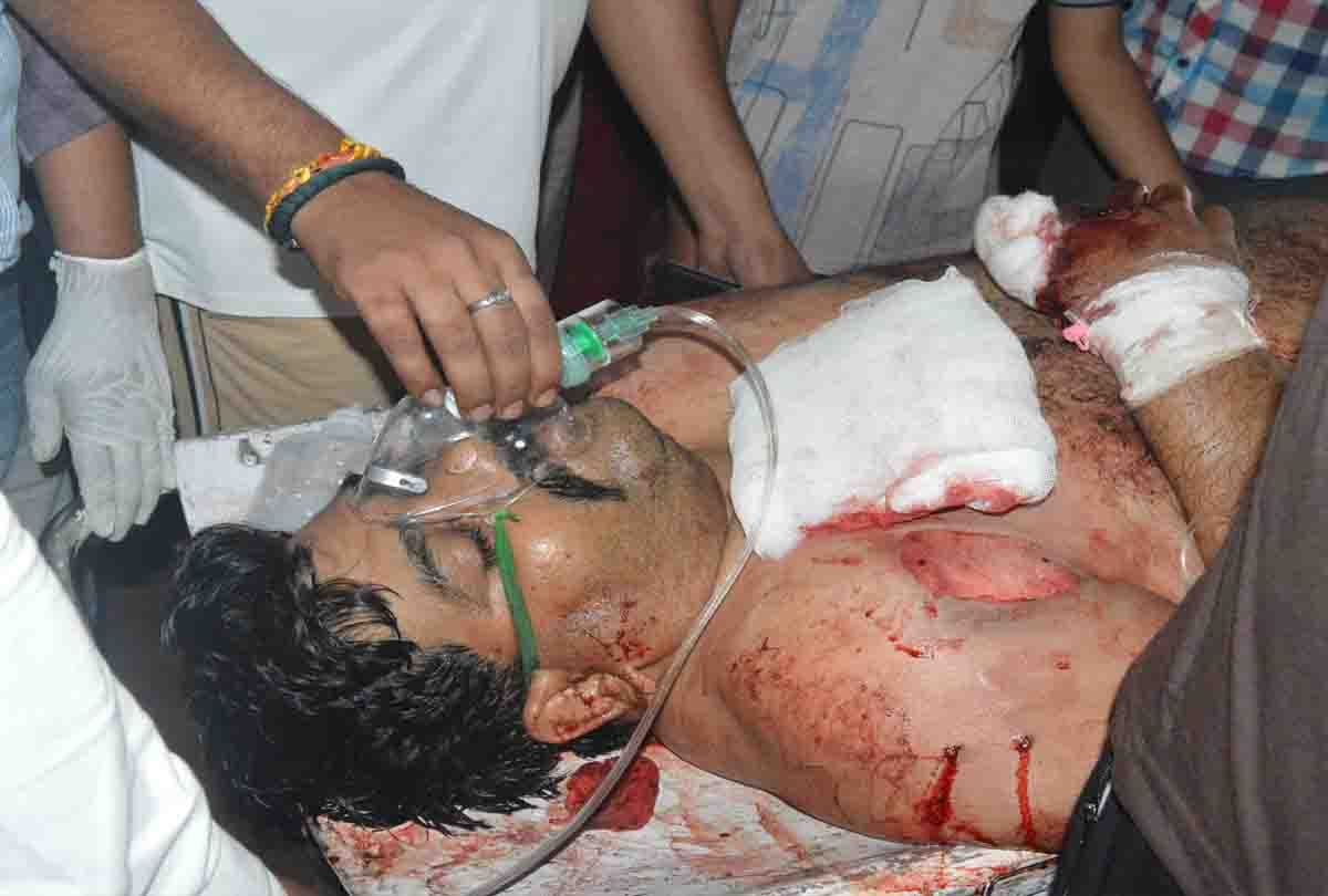 vikas dubey brother injured in gun shot