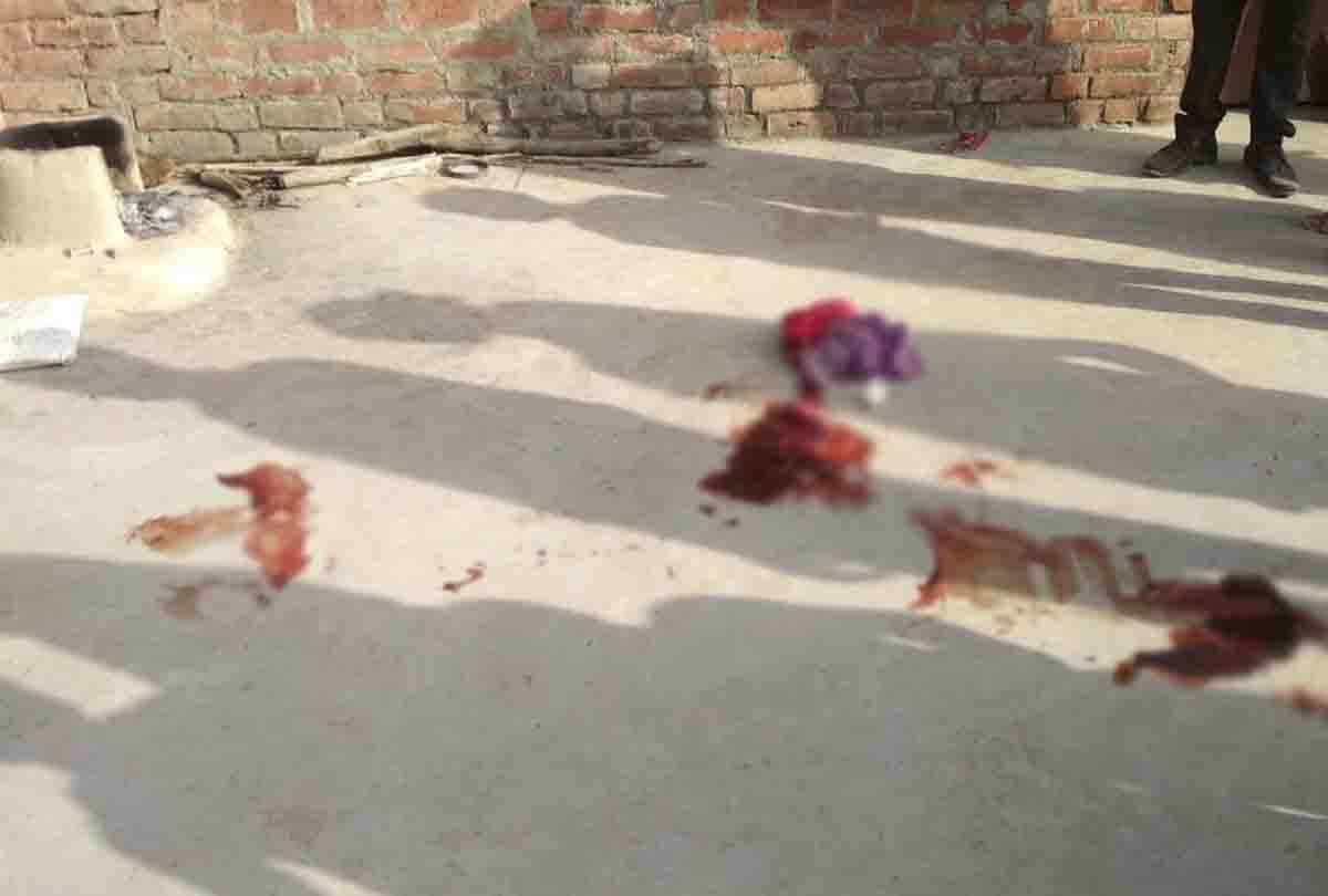 women dead body with gunpowder in up
