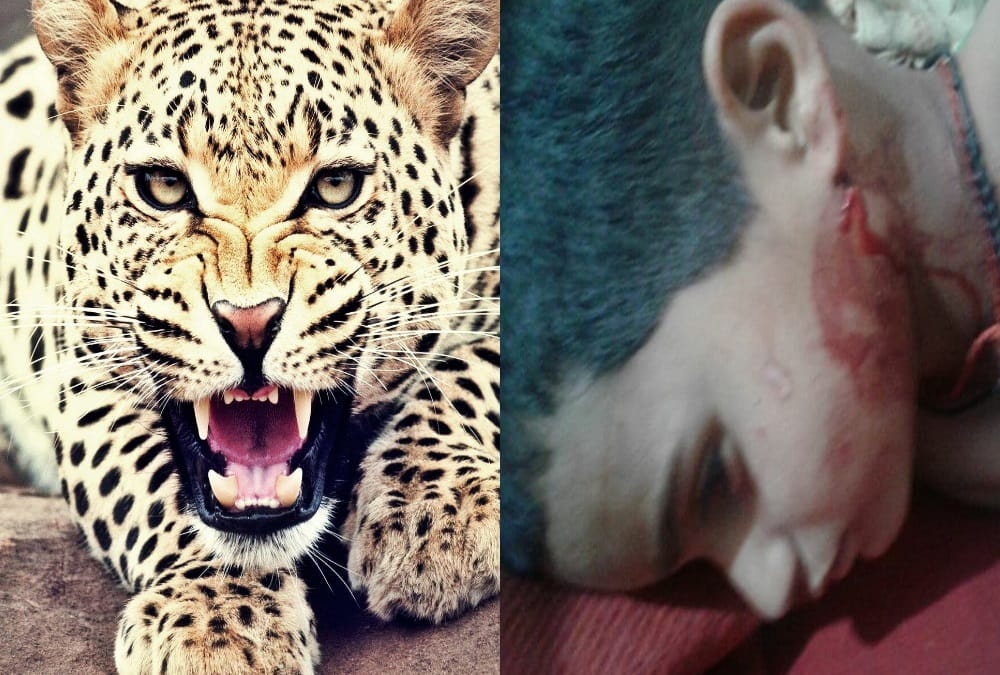 Leopard attack on nine years old boy in tehri