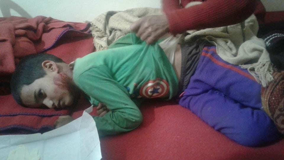 Leopard attack on nine years old boy in tehri