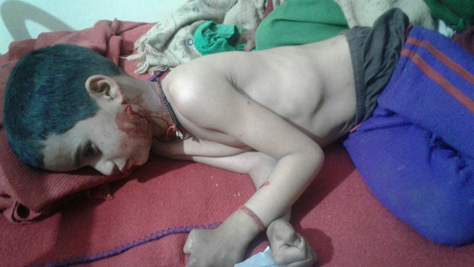 Leopard attack on nine years old boy in tehri