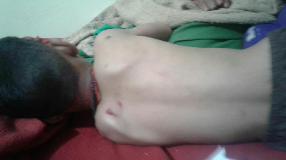 Leopard attack on nine years old boy in tehri