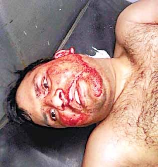 realatives beaten in bamna