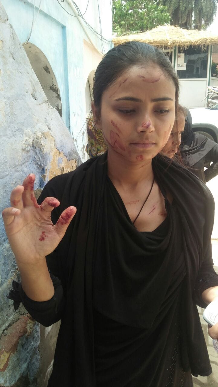 attack on national bravery award winners in agra