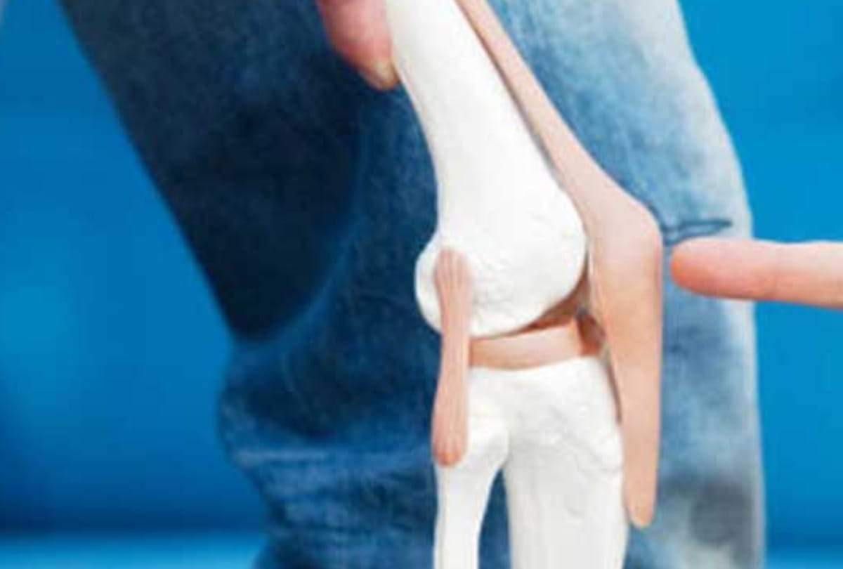 modafinil medicine is harmful for bones