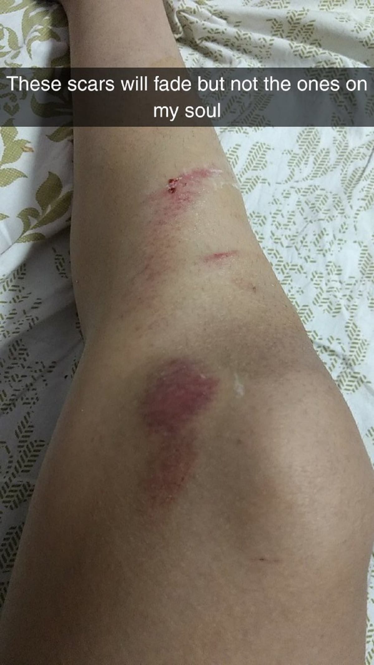 Two guys in Indore tried to pull skirt of a girl while she ridding scooter