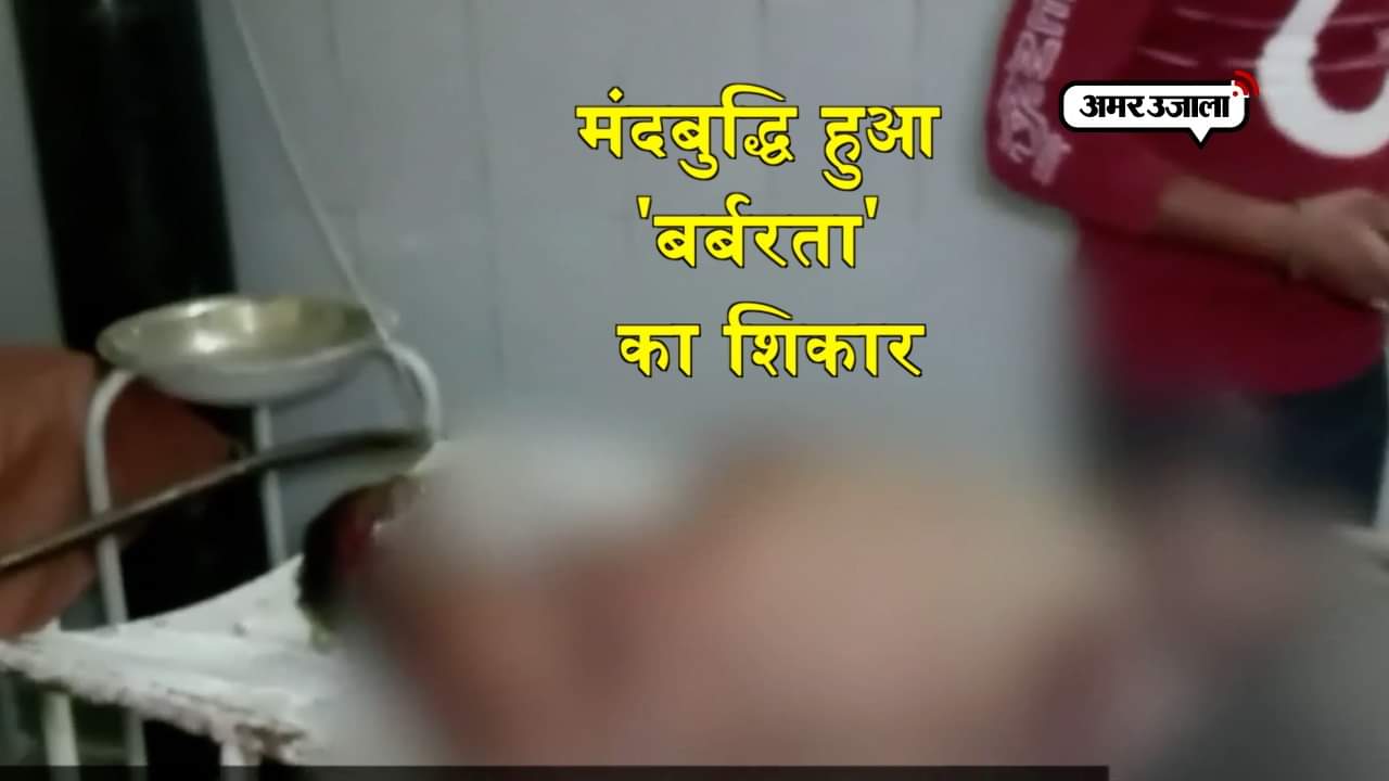 मंदबुद्धि