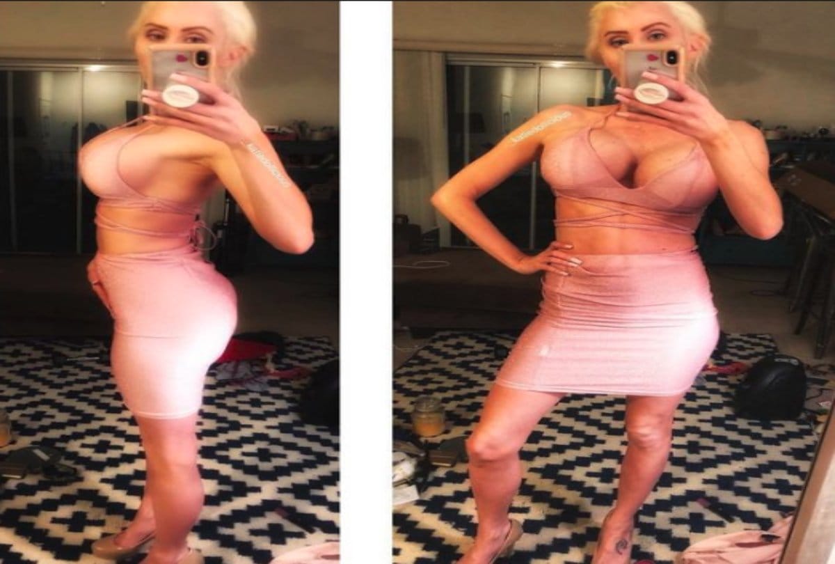 Girl wants to look like barbie doll spend forty thousand dollars