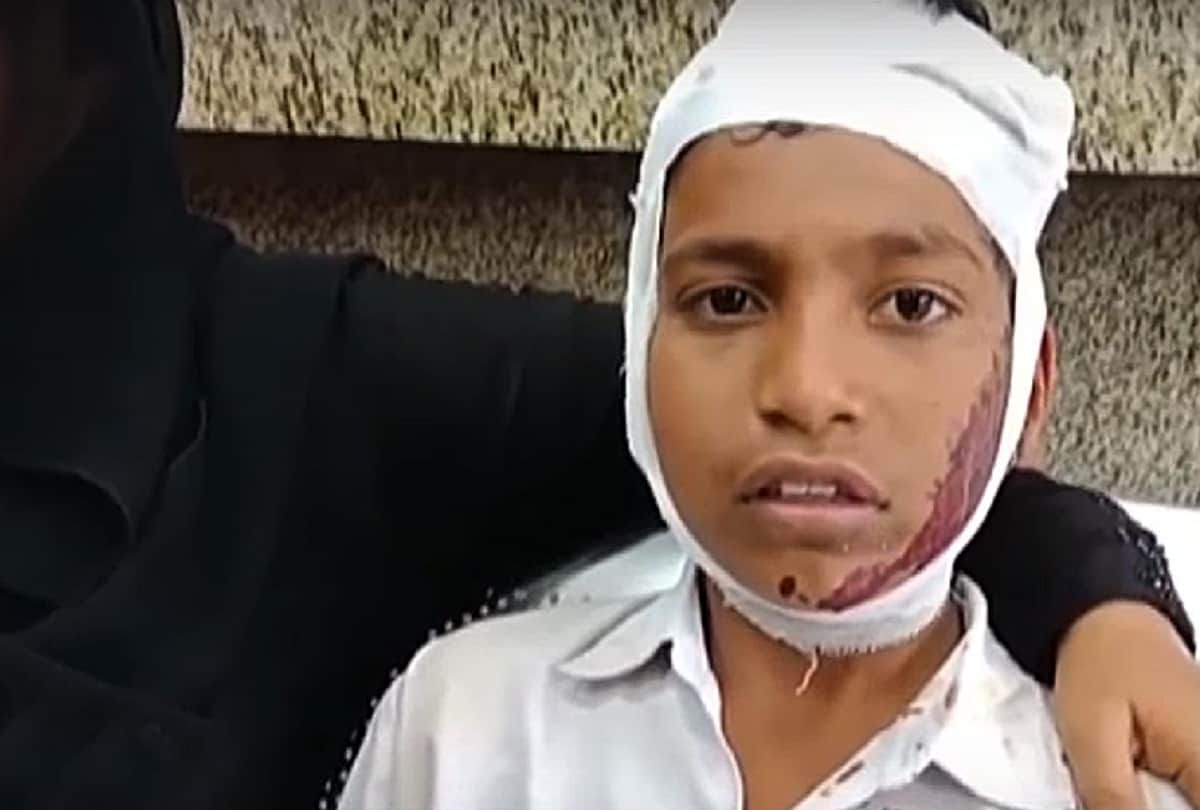 school van driver of delhi who did accident of 18 children was drunk at time of accident