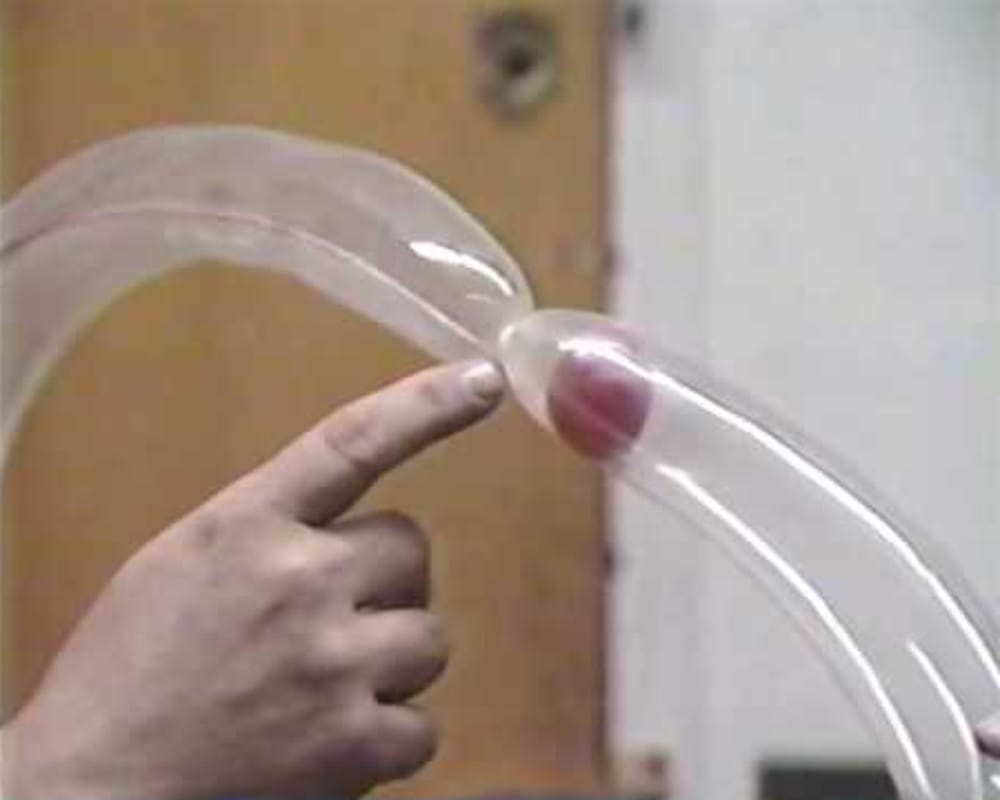 Now treat your heart with electric balloon that fixes hearts using pioneering technique