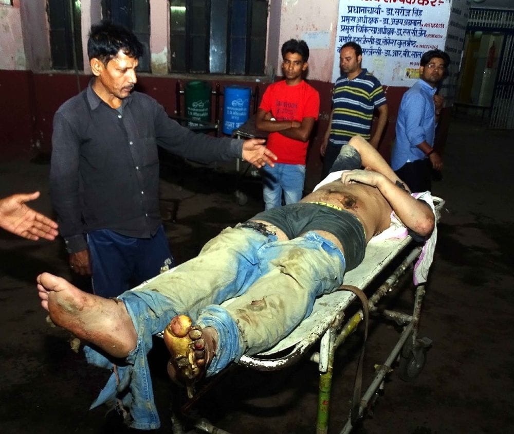 agra police and ambulances reached late for relief