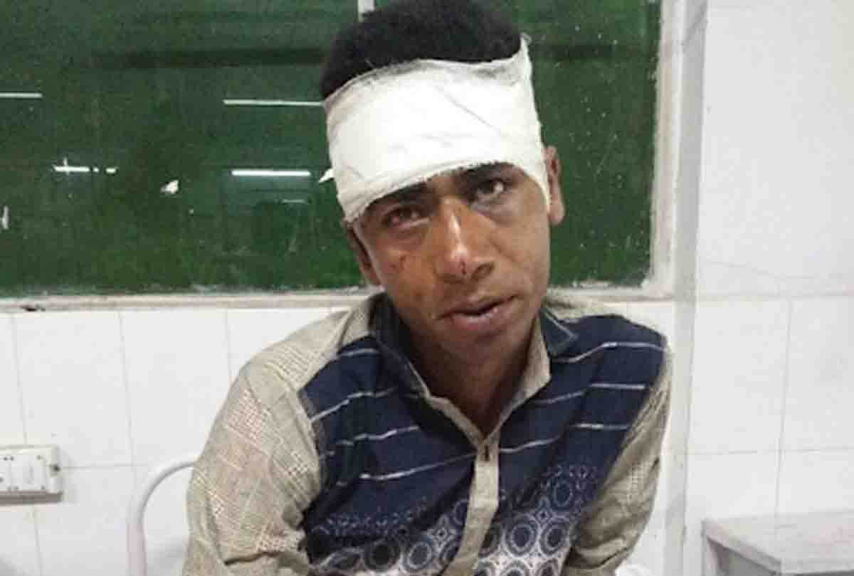 aunt cut private part of his nephew